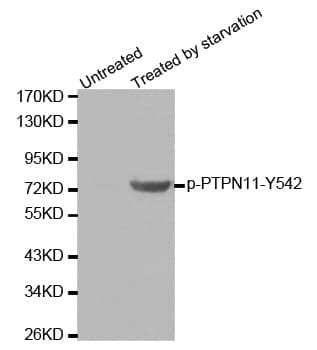 Polyclonal Rabbit anti-Human PTPN11 / SHP-2 / NS1 Antibody (phospho-Tyr542, IHC, WB)