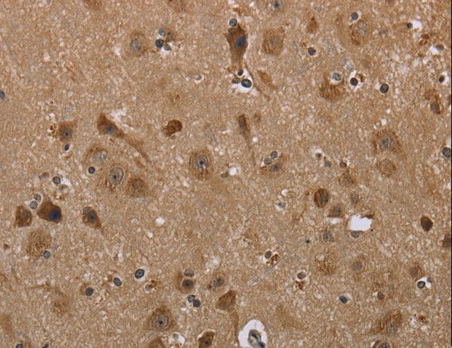LLGL1 / HUGL Antibody