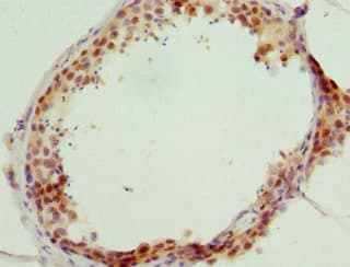 GABPB1 Antibody