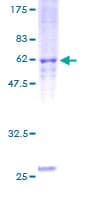 Human RASD2 Protein (Recombinant GST)