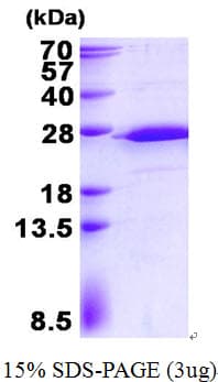 Human RPS5 / Ribosomal Protein S5 (Recombinant His)