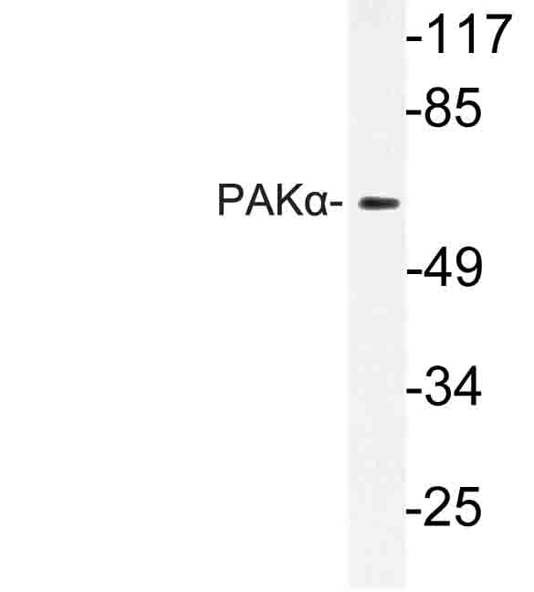 PAK1 Antibody (Lys198)