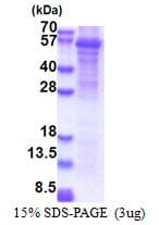Human FAAH2 Protein (Recombinant His)