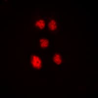 Polyclonal Rabbit anti-Human ZNF148 / ZBP-89 Antibody (N-Terminus, IHC, IF, WB)