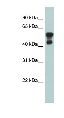 PAFAH1B1 / LIS1 Antibody (aa71-120)