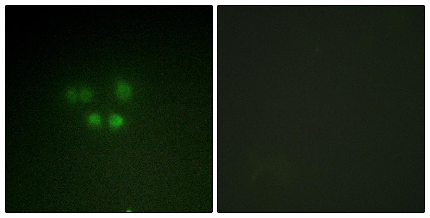 NBN / Nibrin Antibody (p278)