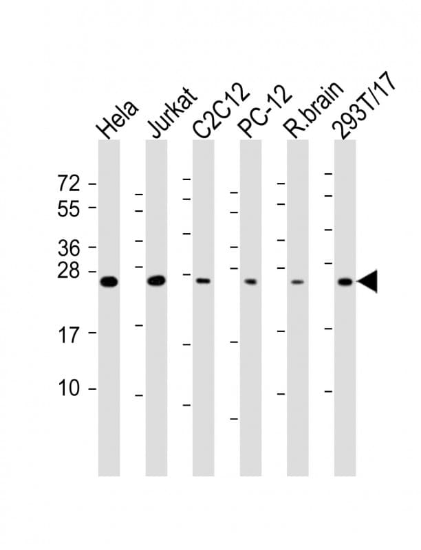 PathPlus™ RAB11A Antibody (clone 1565CT164.36.80)