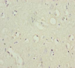 Polyclonal Rabbit anti-Human POU4F3 / BRN3C Antibody (IHC, WB)