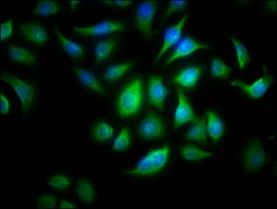 Polyclonal Rabbit anti-Human ALOX15B / 15-LOX-2 Antibody (aa1-676)