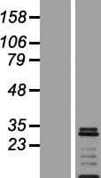 VTI1A Protein (Over-Expression Lysate Myc-DDK (Flag))