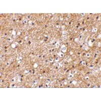 SP110 Antibody