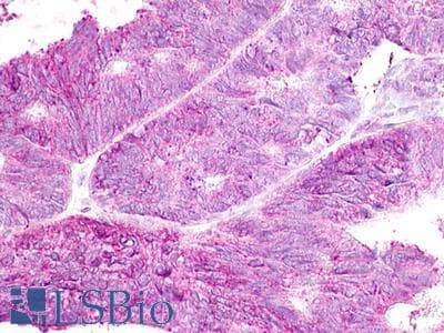 PathPlus™ GPR19 Antibody (Cytoplasmic Domain)