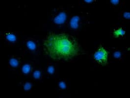 TCTN2 Antibody (clone OTI1C1)