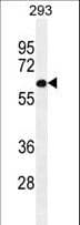 PATL2 Antibody (aa168-196)
