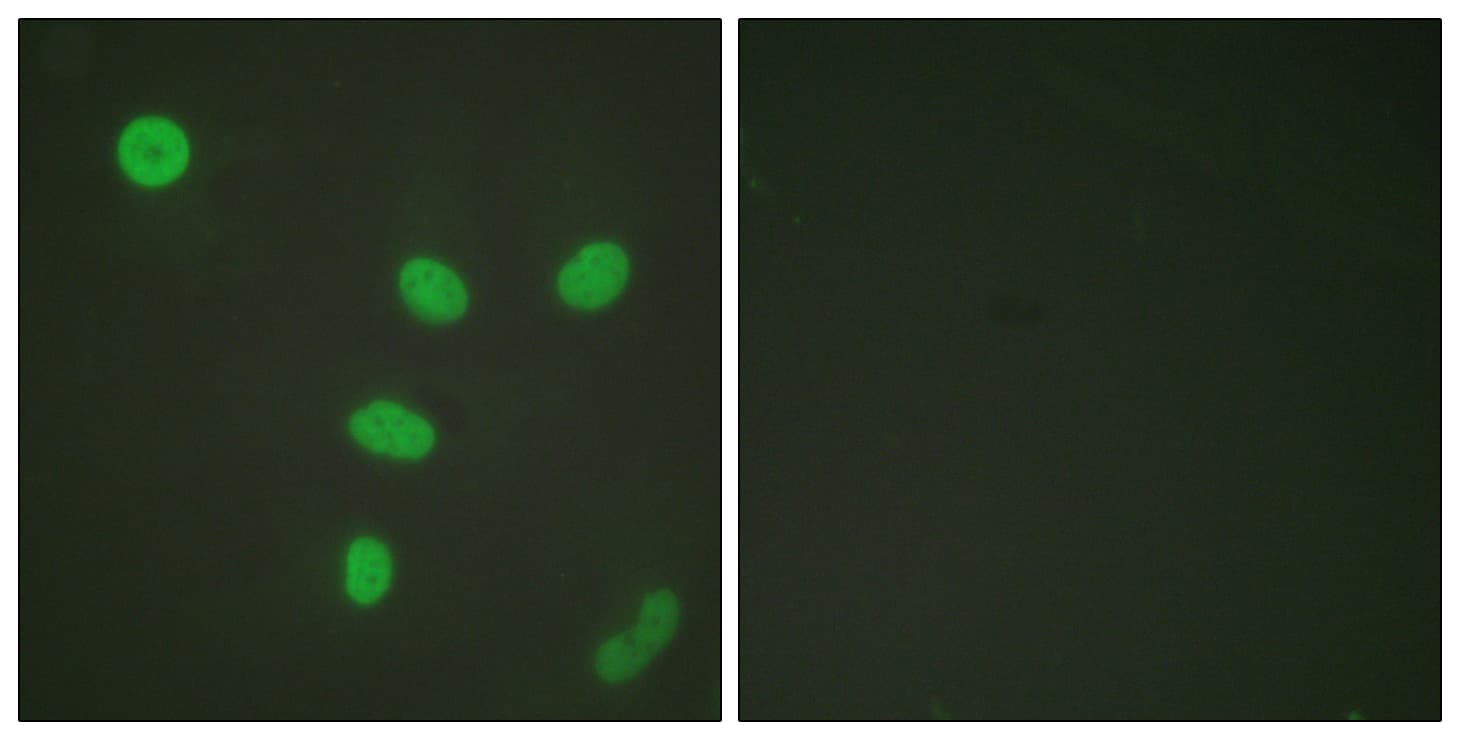 Histone H3 Antibody (Acetyl-Lys27)