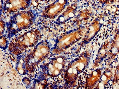 FKBP25 / FKBP3 Antibody (aa2-224)