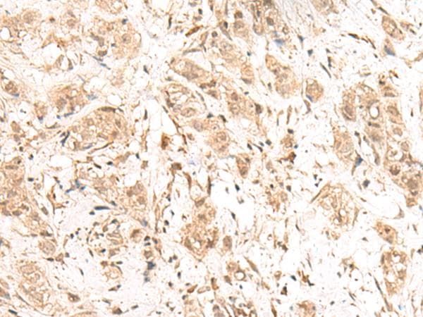 Polyclonal Rabbit anti-Human FIZ1 Antibody (IHC)