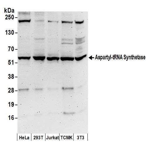 DARS Antibody (aa25-75)