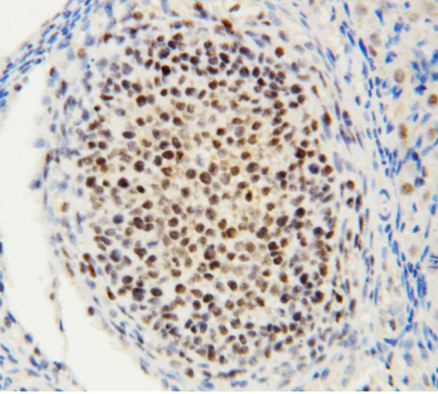 Polyclonal Rabbit anti-Human MTA1 Antibody (aa676-696, IHC, WB)