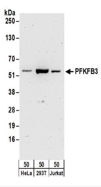 PFK2 / PFKFB3 Antibody (aa470-520)