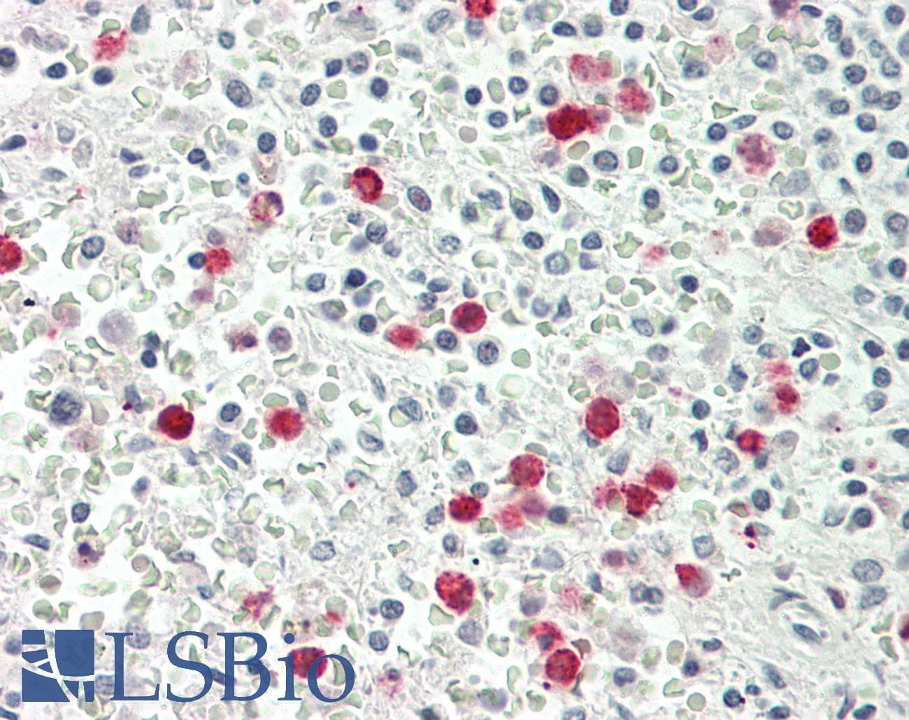 IHC-plus™ Polyclonal Rabbit anti-Human LF / LTF / Lactoferrin Antibody (IHC, WB)