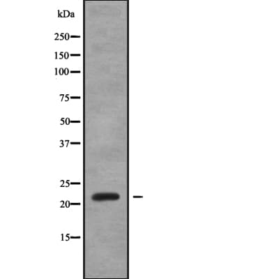 SAR1A / SAR1 Antibody