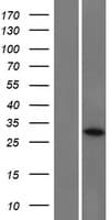 Human CCDC152 Protein (Over-Expression Lysate Myc-DDK (Flag))