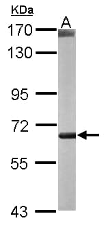 COT / CROT Antibody (aa140-462)