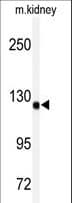 IHC-plus™ ADAMTS19 Antibody (aa298-328)