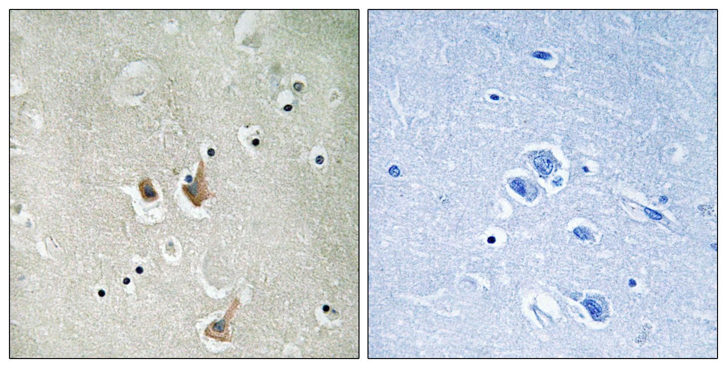 CKS2 Antibody