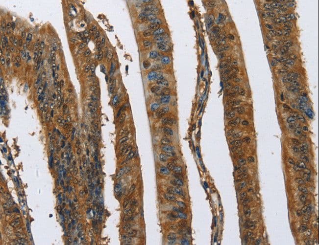CAST / Calpastatin Antibody