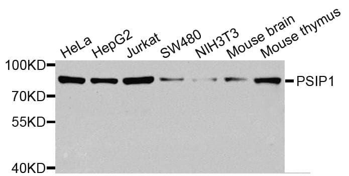 IHC-plus™ PSIP1 / LEDGF Antibody