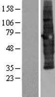 SCAMP3 Protein (Over-Expression Lysate Myc-DDK (Flag))