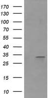 RARRES1 Antibody (clone OTI2E12)