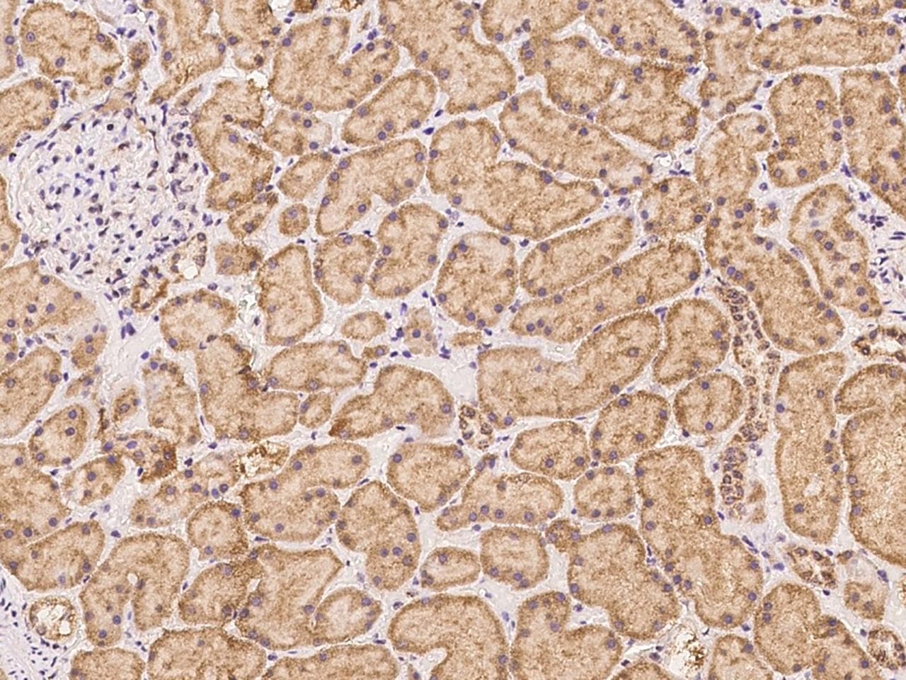 TIMM10B / FXC1 Antibody