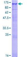 Human OCRL Protein (Recombinant GST)