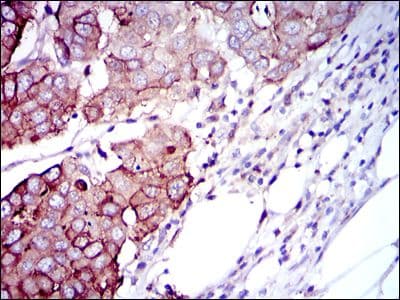RPS6KB1 / P70S6K / S6K Antibody (clone 5G9)