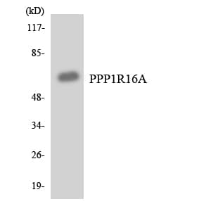 Polyclonal Rabbit anti-Human PPP1R16A Antibody (aa345-394, WB)