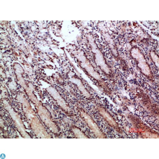 TFF1 / pS2 Antibody
