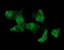 MSI1 / Musashi 1 Antibody (clone OTI3C2, Carrier-free)