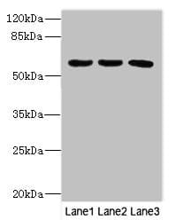 Polyclonal Rabbit anti-Human PIK3R3 / p85 Gamma Antibody (IHC, WB)