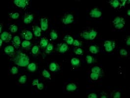 ASCC1 Antibody (clone OTI1E2)