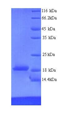 Human RAVER2 Protein (Recombinant His)