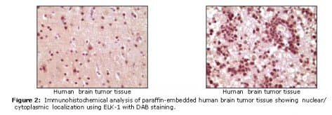 ELK1 Antibody (clone 3H6D12, 4H9C8, 4H9F1)