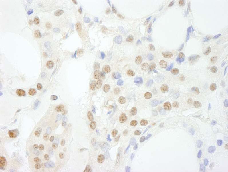 Polyclonal Rabbit anti-Human GTF3C3 Antibody (aa475-525, IHC)
