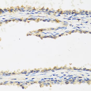 SPINT1 / HAI-1 Antibody