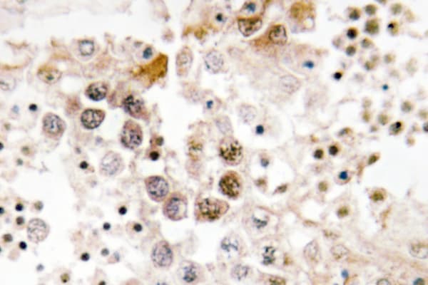 FOXL1 Antibody (Gly150)