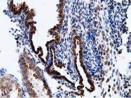 KHK / Ketohexokinase Antibody (clone OTI3D1)