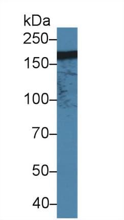 ITGAM / CD11b Antibody (aa31-160)