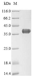 Human AGTRAP / ATRAP Protein (Recombinant 10His-SUMO, N-terminus + Myc, C-terminus)